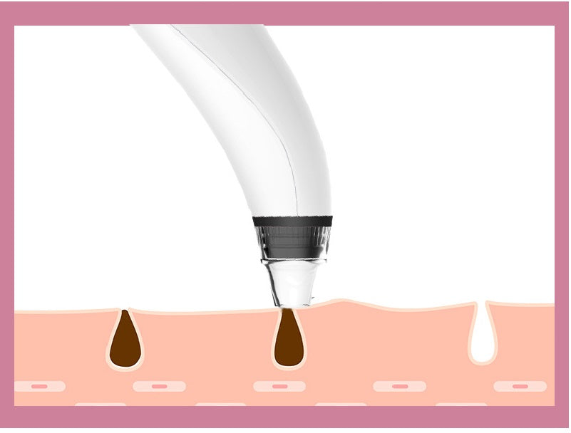 ASPIRATEUR POINT NOIR AVEC CAMERA INTEGREE